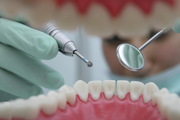 Best Treatment For Dental Implants - Call Now