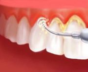 Cusp Dental & Maxillofacial Centre – Gurugram